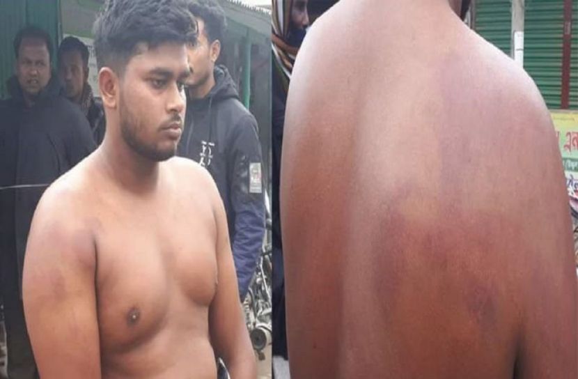 বোয়ালমারীতে শিক্ষার্থীকে আটকে রেখে বেধড়ক মারপিট