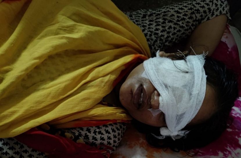 সিলিং ফ্যানের আঘাতে চোখ হারালেন শিক্ষিকা