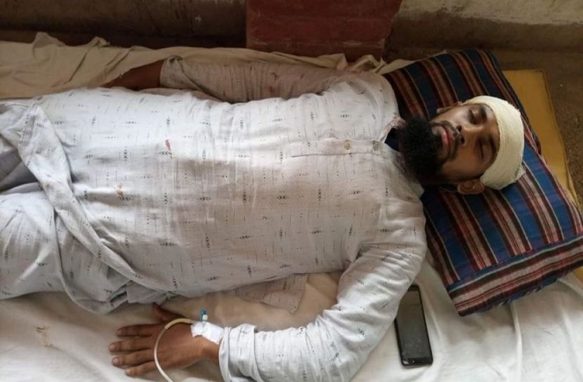 প্রতিপক্ষের মারপিটে আহত ২