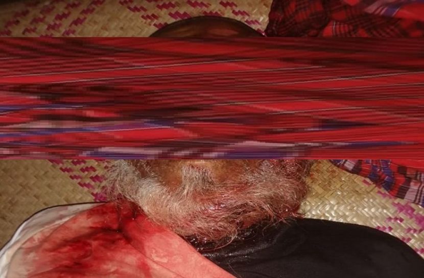 সিএনজি চাপায় প্রাণ গেল বৃদ্ধের